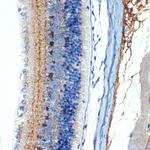 CRABP1 Antibody in Immunohistochemistry (Paraffin) (IHC (P))