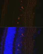 CRABP1 Antibody in Immunohistochemistry (Paraffin) (IHC (P))