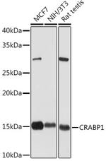 CRABP1 Antibody in Western Blot (WB)