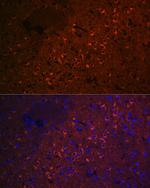 CEND Antibody in Immunocytochemistry (ICC/IF)