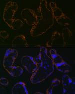 CYP26A1 Antibody in Immunocytochemistry (ICC/IF)