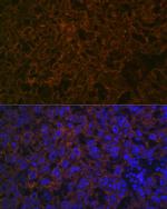 CYP26A1 Antibody in Immunocytochemistry (ICC/IF)