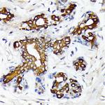 CYP26A1 Antibody in Immunohistochemistry (Paraffin) (IHC (P))