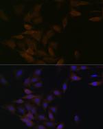 PP2A alpha/beta Antibody in Immunocytochemistry (ICC/IF)