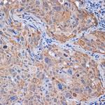 PP2A alpha/beta Antibody in Immunohistochemistry (Paraffin) (IHC (P))