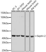 Septin 2 Antibody in Western Blot (WB)