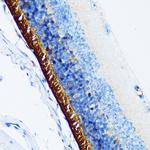 Rhodopsin Antibody in Immunohistochemistry (Paraffin) (IHC (P))