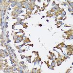 KARS Antibody in Immunohistochemistry (Paraffin) (IHC (P))