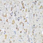 KARS Antibody in Immunohistochemistry (Paraffin) (IHC (P))