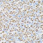 NDUFS4 Antibody in Immunohistochemistry (Paraffin) (IHC (P))