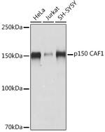 CAF1 p150 Antibody in Western Blot (WB)