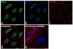 TRBP Antibody in Immunocytochemistry (ICC/IF)