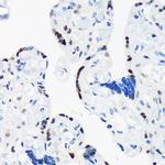 TRBP Antibody in Immunohistochemistry (Paraffin) (IHC (P))