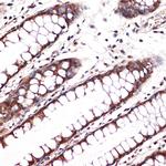 Carbonic Anhydrase II Antibody in Immunohistochemistry (Paraffin) (IHC (P))