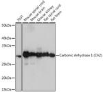 Carbonic Anhydrase II Antibody in Western Blot (WB)