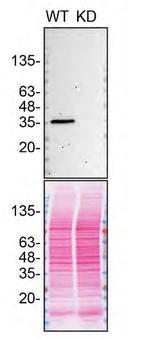 CK1 alpha Antibody