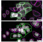 CK1 alpha Antibody