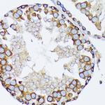 gamma Tubulin Antibody in Immunohistochemistry (Paraffin) (IHC (P))