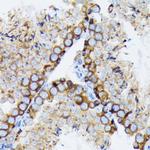 gamma Tubulin Antibody in Immunohistochemistry (Paraffin) (IHC (P))