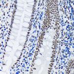 PIAS1/PIAS2 Antibody in Immunohistochemistry (Paraffin) (IHC (P))