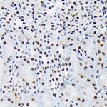 PIAS1/PIAS2 Antibody in Immunohistochemistry (Paraffin) (IHC (P))