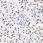 UAP56 Antibody in Immunohistochemistry (Paraffin) (IHC (P))