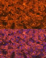 A2M Antibody in Immunohistochemistry (Paraffin) (IHC (P))