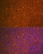 A2M Antibody in Immunohistochemistry (Paraffin) (IHC (P))