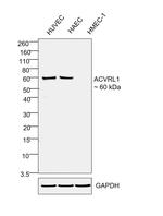 ACVRL1 Antibody