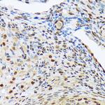 HES5 Antibody in Immunohistochemistry (Paraffin) (IHC (P))