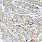 Cytokeratin 1 Antibody in Immunohistochemistry (Paraffin) (IHC (P))