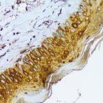 Cytokeratin 1 Antibody in Immunohistochemistry (Paraffin) (IHC (P))