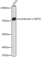 Cytokeratin 1 Antibody in Western Blot (WB)