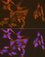 USP9X Antibody in Immunocytochemistry (ICC/IF)