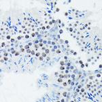 Phospho-p70 S6 Kinase (Thr421) Antibody in Immunohistochemistry (Paraffin) (IHC (P))