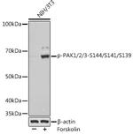 Phospho-PAK1/2/3 (Ser144) Antibody in Western Blot (WB)