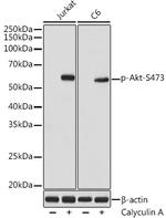 Phospho-AKT1/AKT2/AKT3 (Ser473) Antibody in Western Blot (WB)