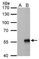 Influenza A NP Antibody in Western Blot (WB)