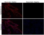 Cytokeratin 14 Antibody in Immunohistochemistry (Paraffin) (IHC (P))