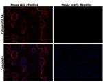 Cytokeratin 14 Antibody in Immunohistochemistry (Paraffin) (IHC (P))