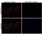 Cytokeratin 14 Antibody