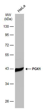 PGK1 Antibody in Western Blot (WB)