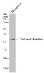 Tyrosine Hydroxylase Antibody in Western Blot (WB)