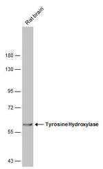 Tyrosine Hydroxylase Antibody in Western Blot (WB)