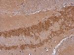 SH3GL1 Antibody in Immunohistochemistry (Paraffin) (IHC (P))