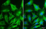 PKM Antibody in Immunocytochemistry (ICC/IF)