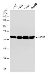 PKM Antibody in Western Blot (WB)