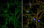 PARK7 Antibody in Immunocytochemistry (ICC/IF)