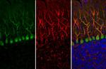 Calbindin Antibody in Immunohistochemistry (Paraffin) (IHC (P))