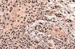 PAX3 Antibody in Immunohistochemistry (Paraffin) (IHC (P))